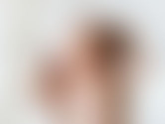 Les déformations crâniennes : causes & conséquences 1/2