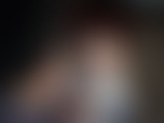 Les freins restrictifs buccaux & approche pluridisciplinaire 2/2