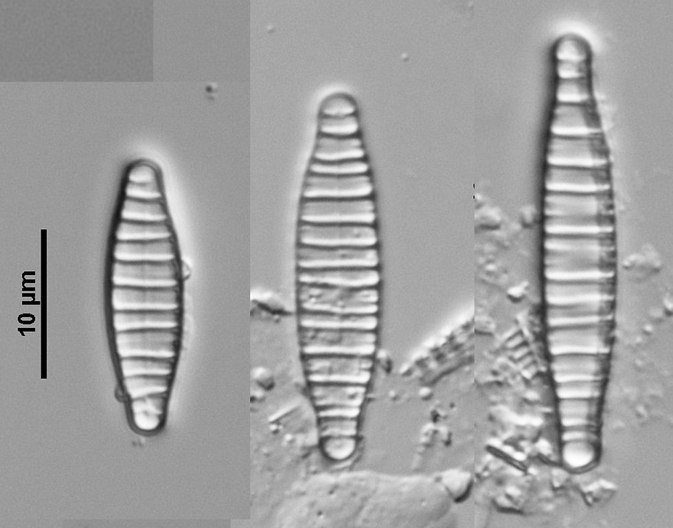 Diatoma (Kütz.) D.M.Williams