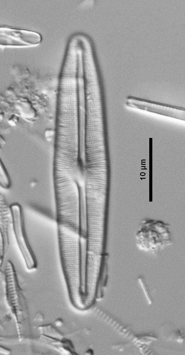 Frustulia vulgaris (Thwaites) DeT.