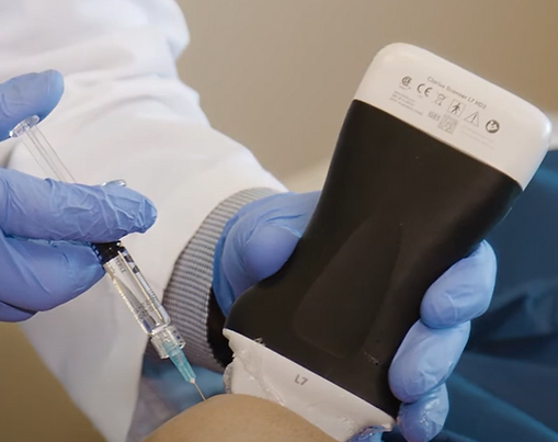 Mesoterapia