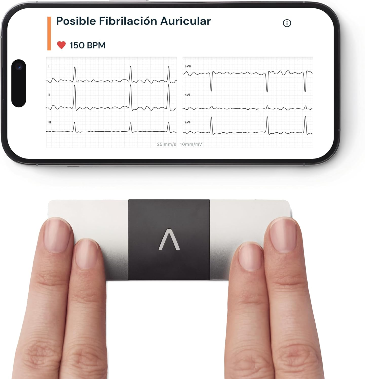 Kardiamobile Electrocardiografo Portatil De 6 Derivaciones – Detecta Fibrilación