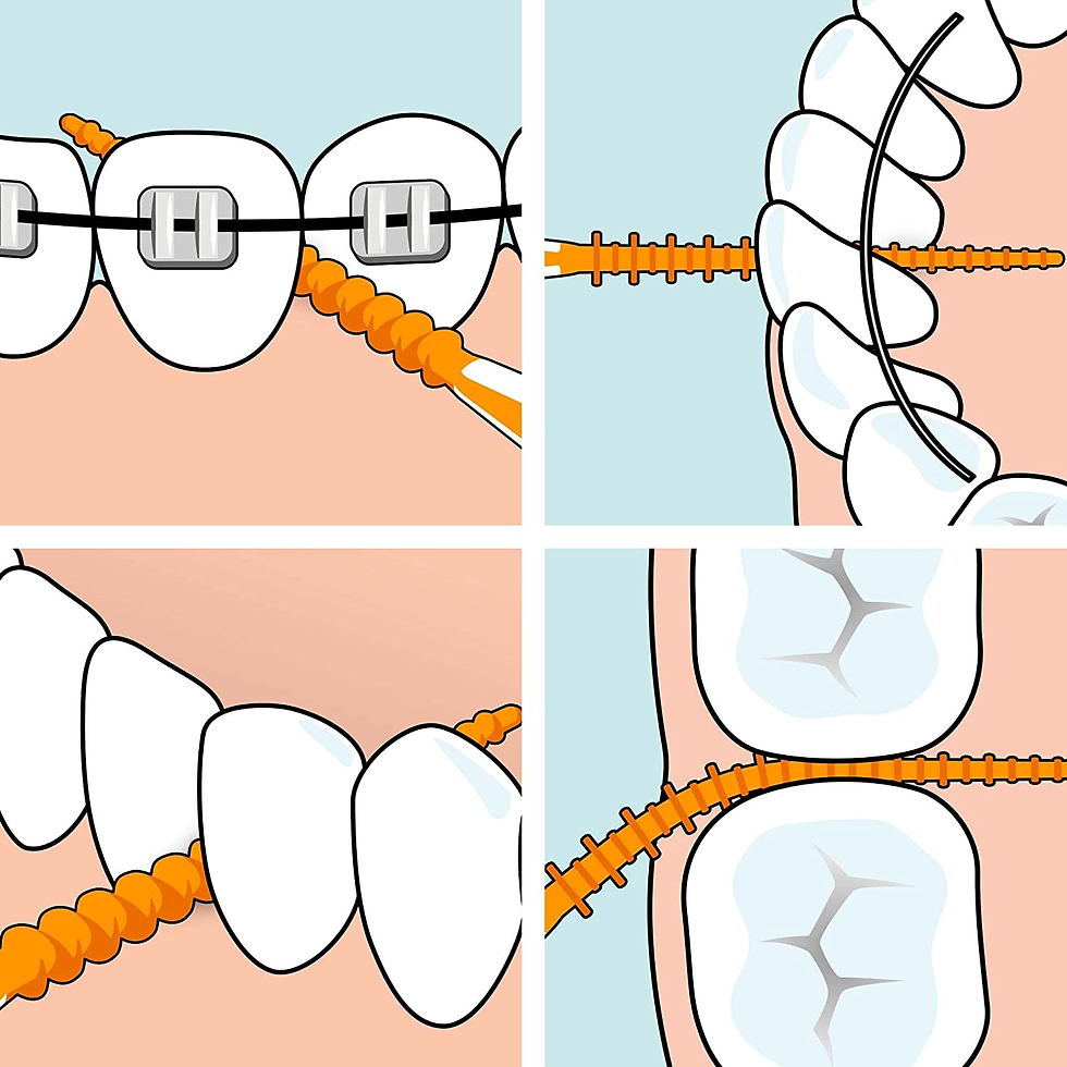 Miniatura: Palillos De Dientes Tepe Easypick, Naranja, ISO XS-S, 60 Ud., Herramienta Para E