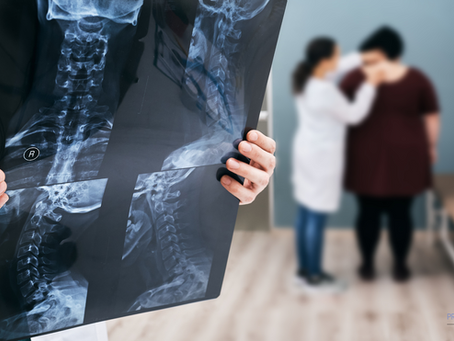 Kyphosis Vertebral Augmentation (Kyphoplasty) Surgical Options