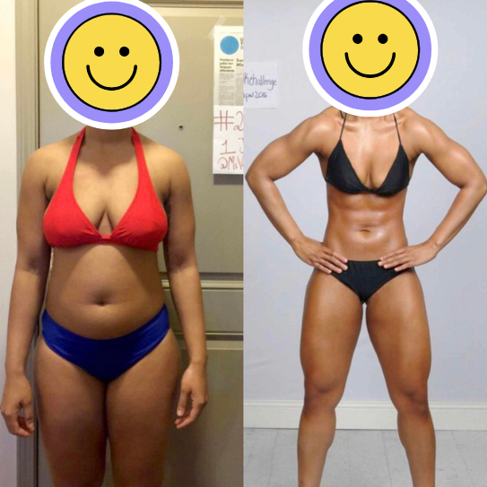 Before & After photos of female client with GLP Weight Loss Success and RF Treatments