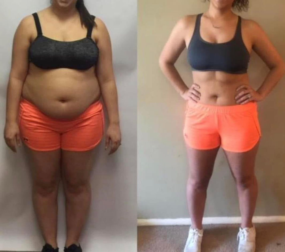 Before & After Photos of woman client with GLP Weight Loss Success and RF Treatments