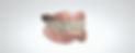 Dentures Screenshot Wix_edited.jpg