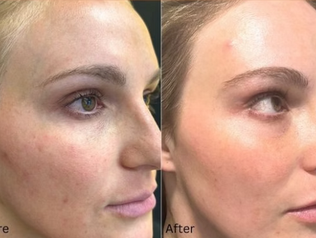 Clear & Brilliant with a Side of Salmon DNA
