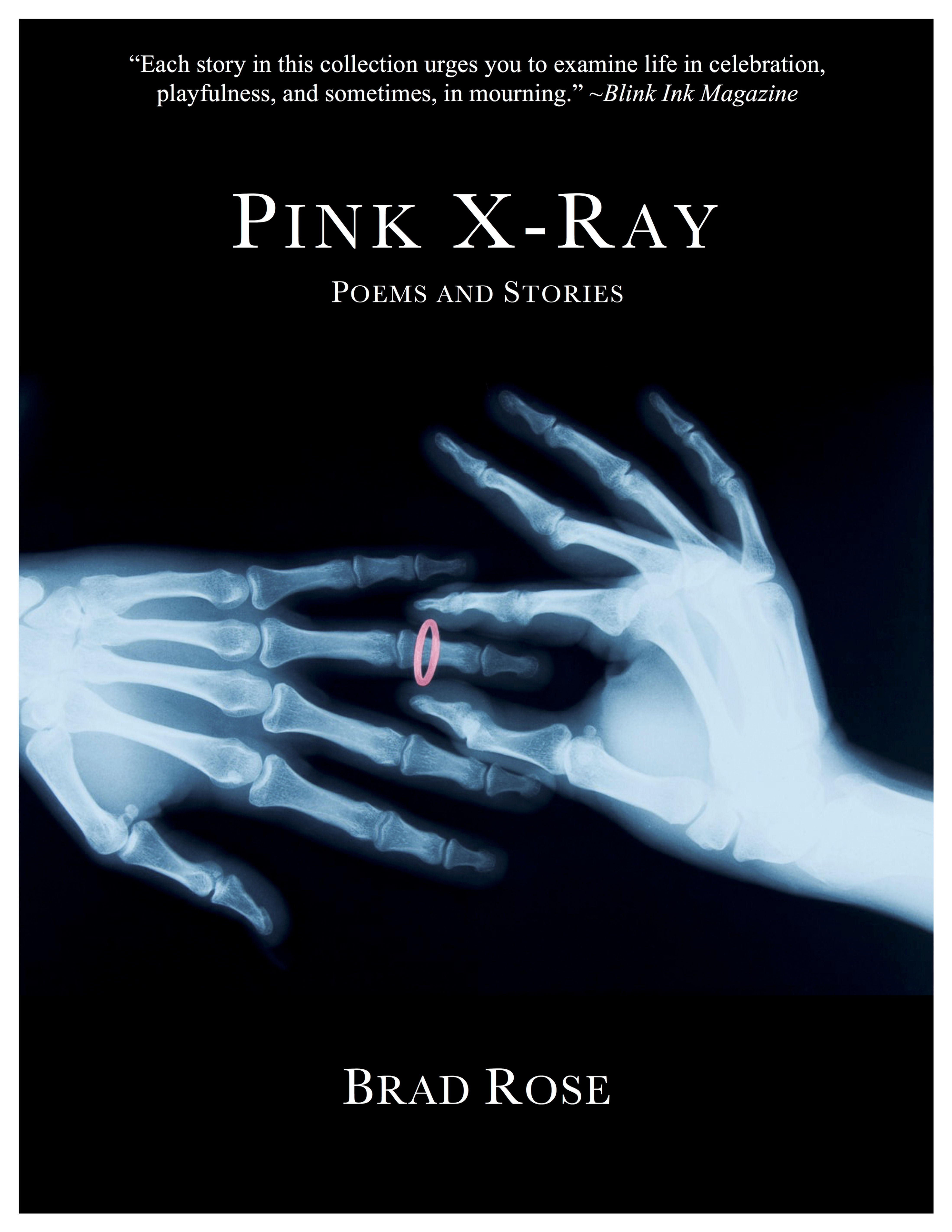 Pink X-Ray