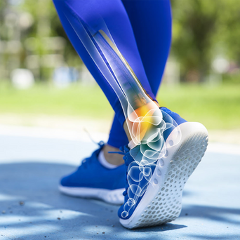Active Person Running On Outdoor Surface With Scerbo Logo On Image And With Person's Ankle Bones And Ligaments Illustrated Like An X-Ray