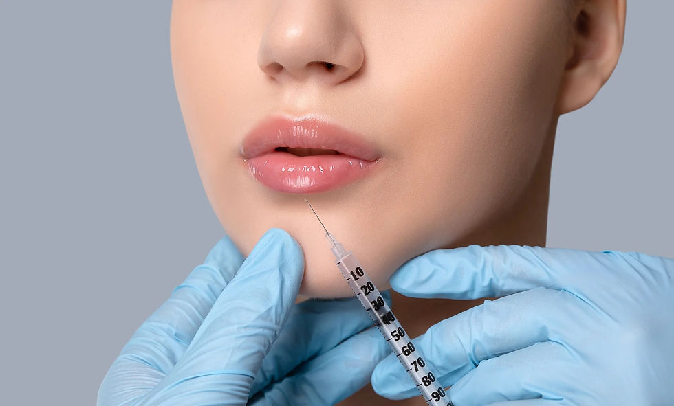 Micro Needle Lip Filler: Top Benefits for Sensitive Lips and Fine Lines