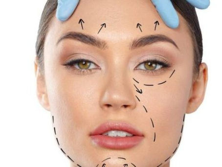 Brow Lift Cost in Vietnam: Get High-End Aesthetic Results for Less