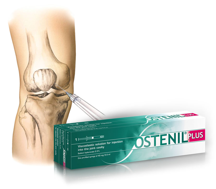 Ostenil Plus hyaluronic acid knee injection
