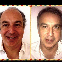 “Professional hair transplant surgery in Istanbul arranged by Boris Hair Studio”