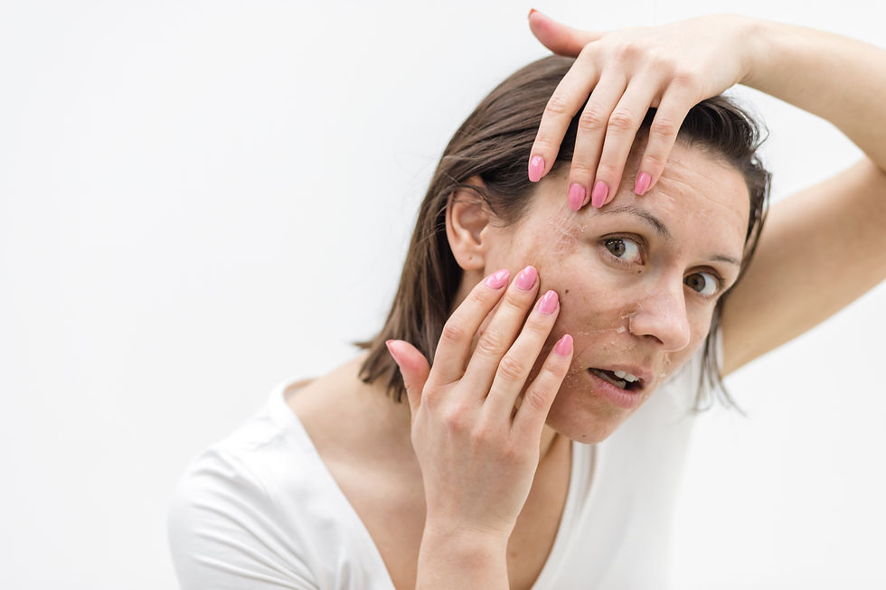 Close-up of a woman inspecting peeling facial skin and redness, showing side effects of overusing skincare actives.