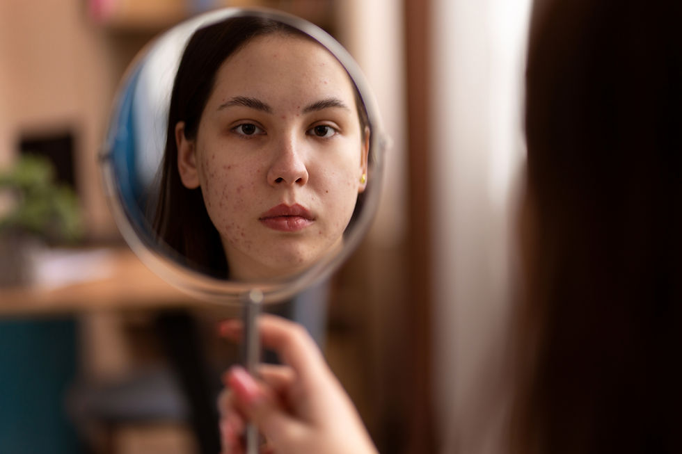 A woman examining her skin texture and facial blemishes in a vanity mirror for treatment of acne, rosacea, and skin pigmentation