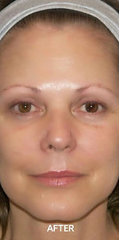 dual-injector after.jpg