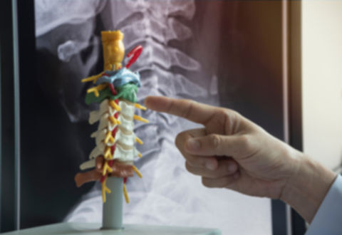 injured, rehabilitation, rehab, dynamic, corrective, balance