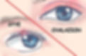Illustration showing the difference between a stye (painful, red bump on the eyelid edge) and a chalazion (painless lump on the eyelid), helping to identify the two common eye conditions.