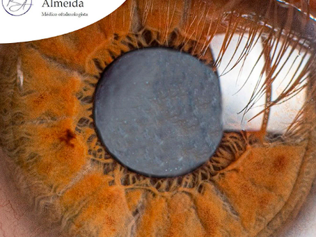 Como evitar complicações após a cirurgia de catarata?