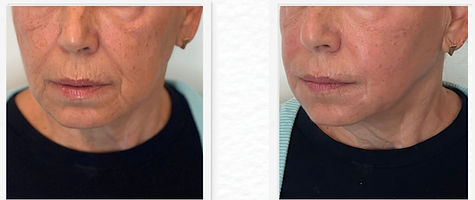 סבינה לפני ואחרי 4.jpg.jpg