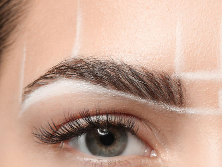 Browlift