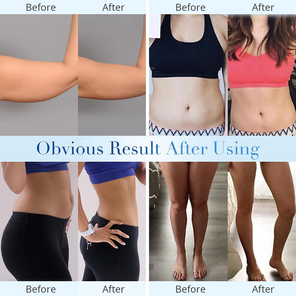 Thumbnail: Portable Ultrasonic Cavitation Machine 60K Weight Loss Beauty Massager