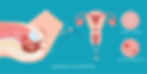 diagnostic hysteroscopy singapore
