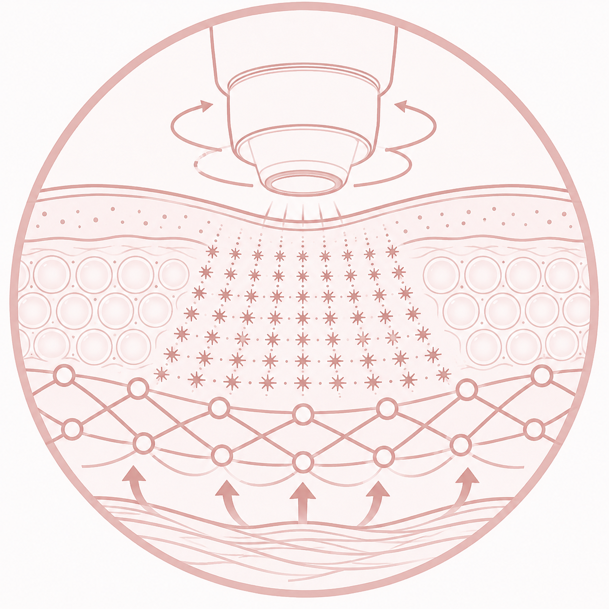 Ultraformer MPT 微脈衝懸吊提拉.png