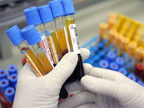 A New Era In Disease Prediction