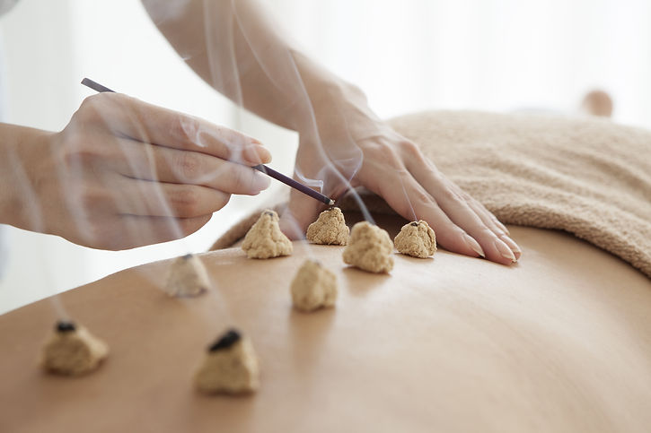 Moxibustion or moxa in Hopespring Wellness in Bellevue