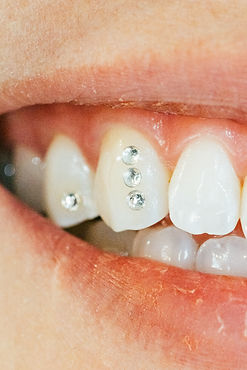 tooth gem installation at Panther & The Pearl in the Santa Cruz Mountains