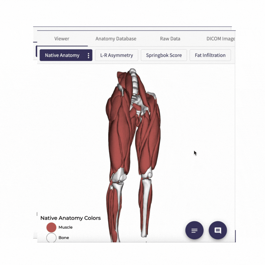 This gif shows a brief demonstration of the Springbok Analytics viewer. It shows how the lower extremity muscles can be viewed interactively, with colour codes showing muscle volume asymmetries and other statistics.