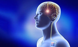 deep-brain-stimulation-500x292-1024x585.