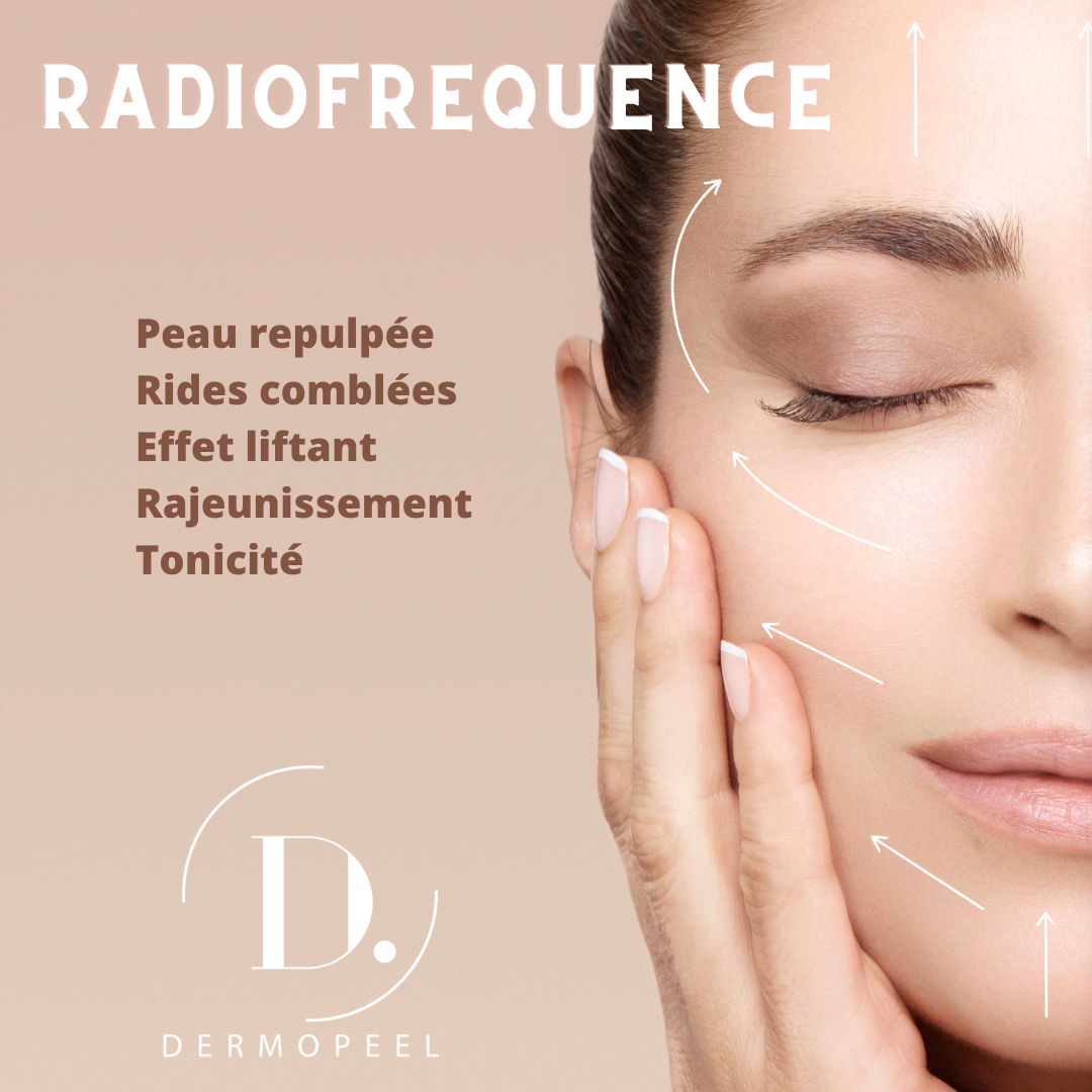 radiofrequence-multipolaire-fractionnee.webp