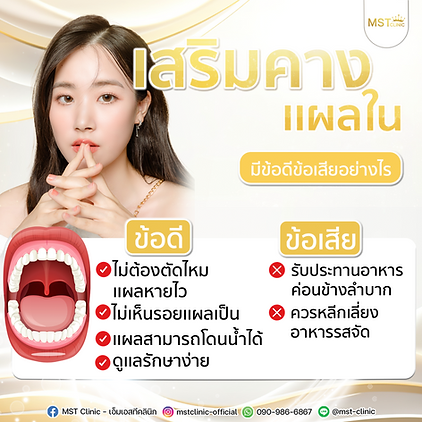 เสริมคางเเผลในขา-1-12-6-2023.png