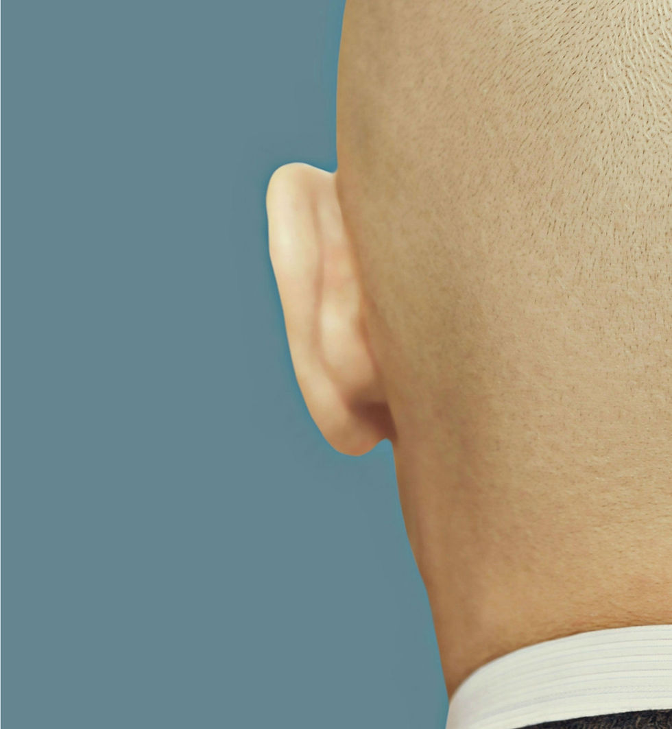 Miniature : Mr Strange - Crâne d'oeuf II