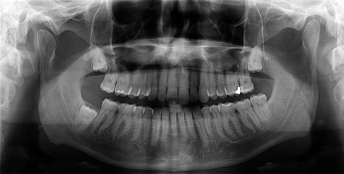 Mark E. Sherer DDS