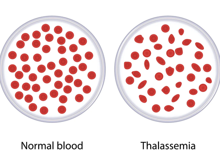 Thalassemia