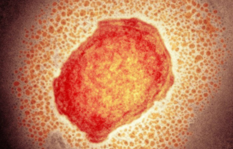 The Rise of Monkeypox