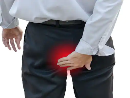 Hemorrhoids Treatment by Naturopathy: 3 Marvelous Effective Herbal medicines for Piles