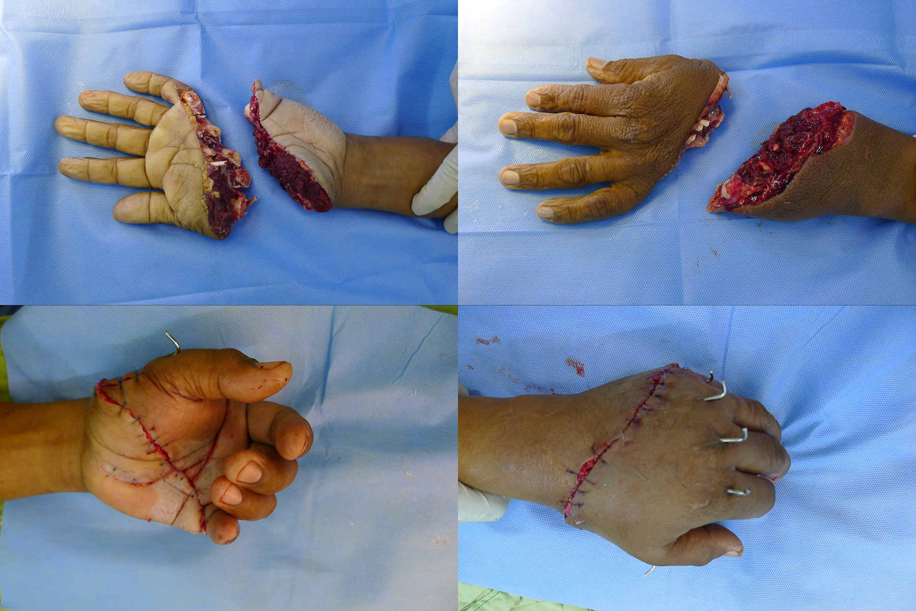 Divisions and Services | upcm-pgh-orthopedics