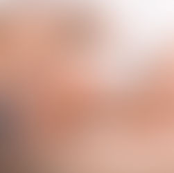 The Benefits of Mobile Acupuncture: Why Home Treatments May Enhance Your Healing Journey