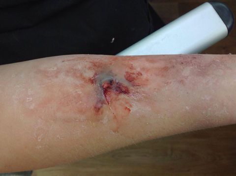 SFX Makeup Artist, Special effects makeup artist, Film and T.V Makeup artist. TV Makeup Artist, Film Makeup Artist, Broadcasting Makeup Artist, Media Makeup Artist, Shropshire Makeup Artist, Shrewsbury Makeup Artist, Powys Makeup Artist, Wales Makeup Artist, London Makeup Artist.