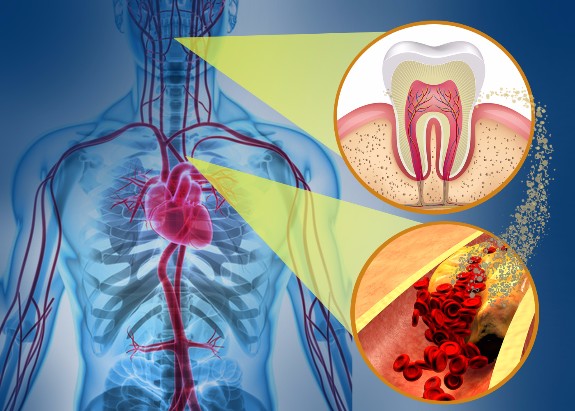 Mouth and Body connection | Launch Oral Systemic Health