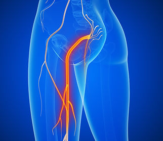 Horizon Wellness - Chiro Image - Sciatica2_edited.jpg