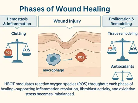 Wound Healing and Hyperbaric Oxygen Therapy Physiology: Oxidative Damage and Antioxidant Imbalance