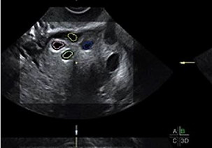 Normale riserva ovarica.JPG