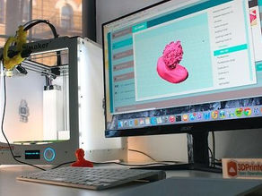 3D Concrete Printing Market Size, Share, Trends, & Industry Analysis Report By System