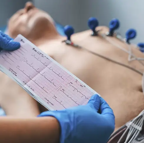 ELETROCARDIOGRAMA.webp